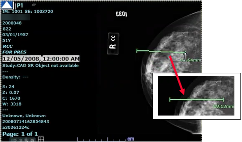 Ruler Annotation Example in the Viewer